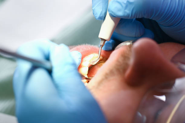 Best Emergency Gum Pain Relief  in Sullivans Island, SC